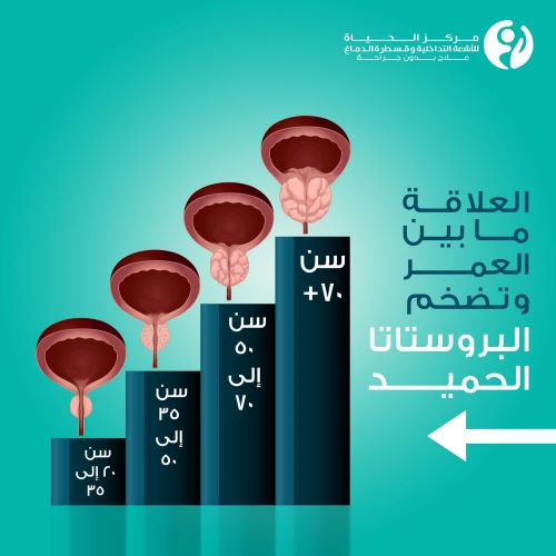 علاج تضخم البروستاتا بدون جراحة